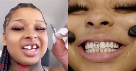 why does chrisean rock have a missing tooth|Chrisean Rock Gets Her Tooth Fixed & Says She Wants A Gap